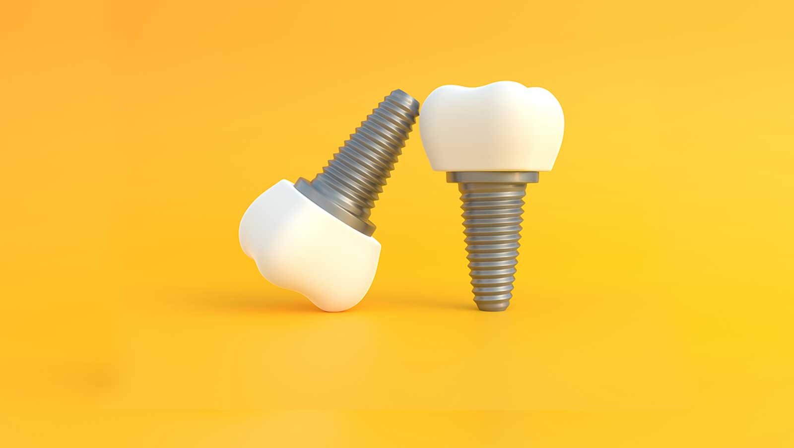 Dental Implants